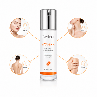 Acne Nursing Cream Moisturizes Skin