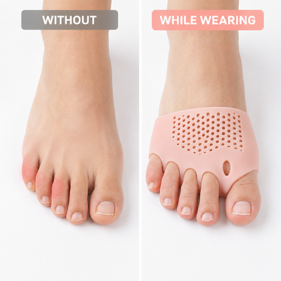 Cerelique™ Hammer Toe Straighteners